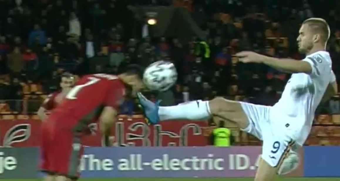 Cum arată victima lui George Pușcaș, după intrarea criminală a atacantului. Foto. Sursă foto: fanatik.ro